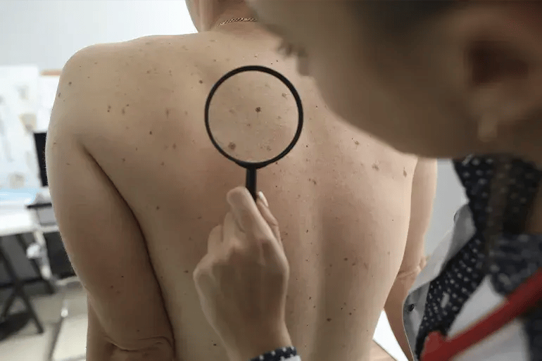 CUERPO_1_When_is_a_consultation_with_a_dermatologist_necessary