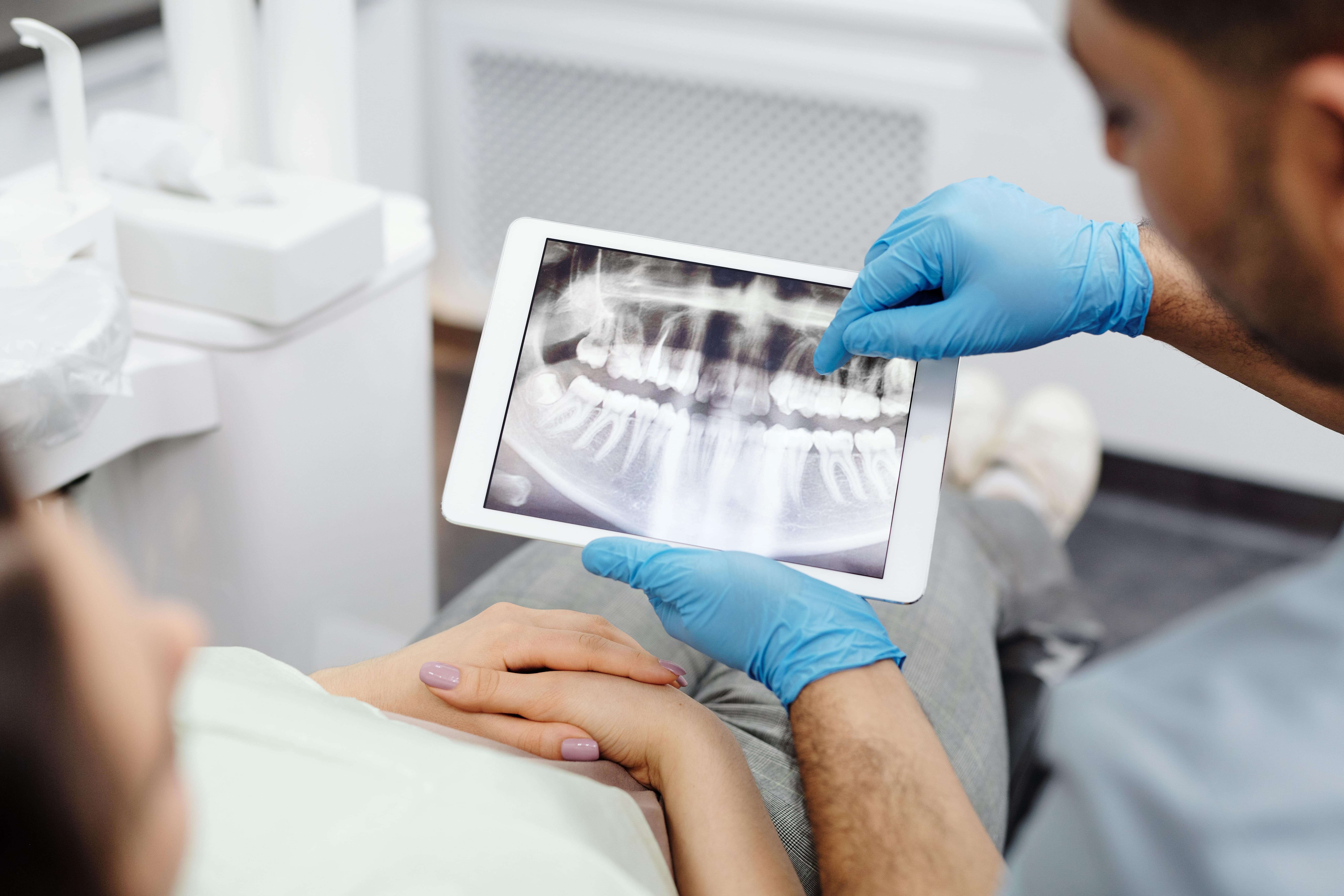 individual dental insurance for xrays