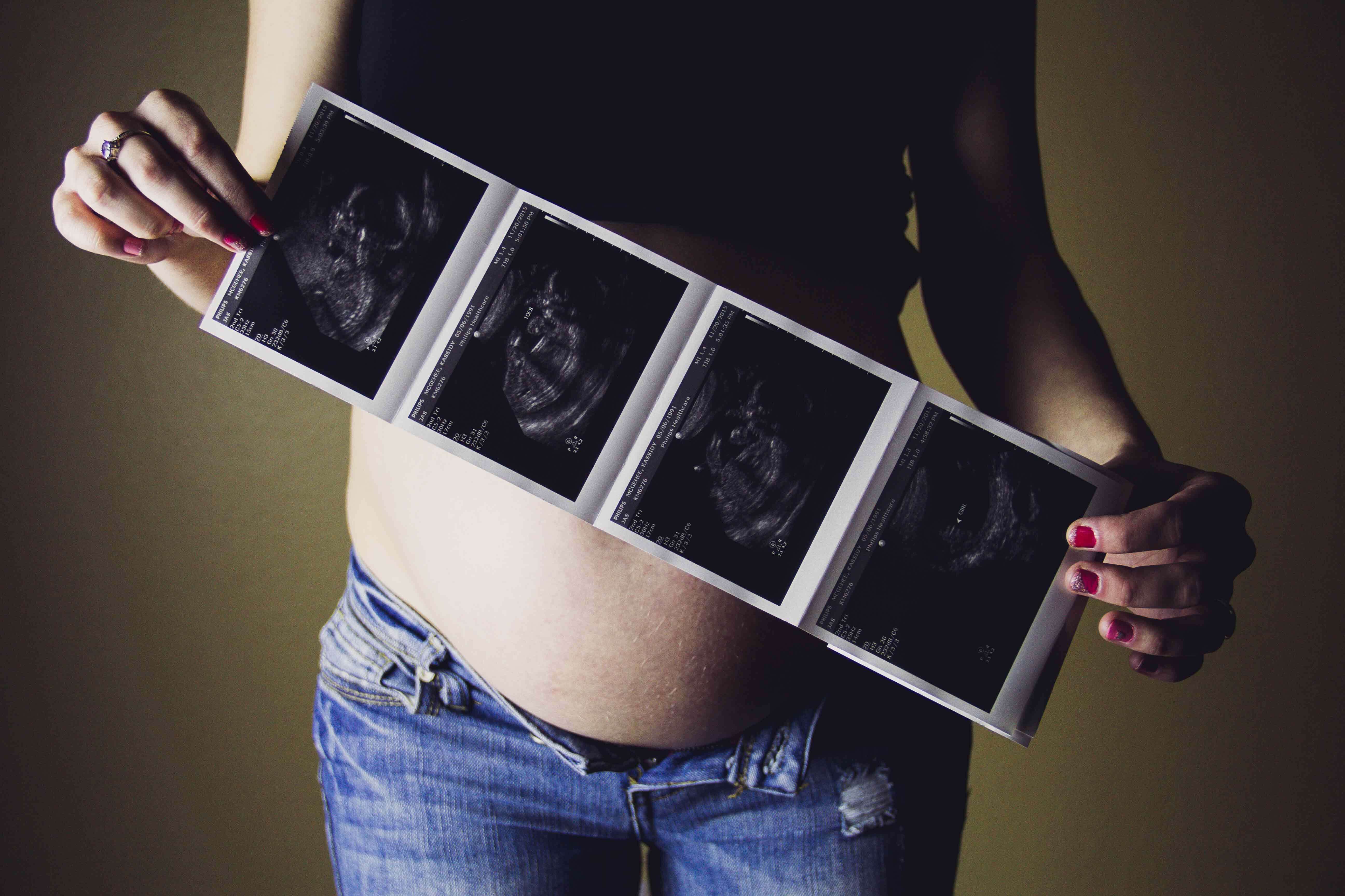 tests during pregnancy might include a sonogram