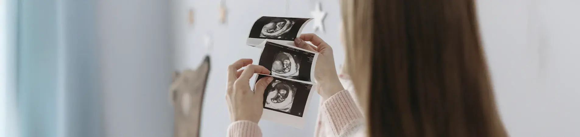 sonogram picture of pregnancy facts and myths