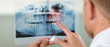 Dentascan