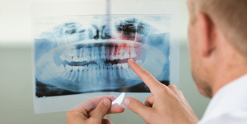 Dental_Insurance_dentascan